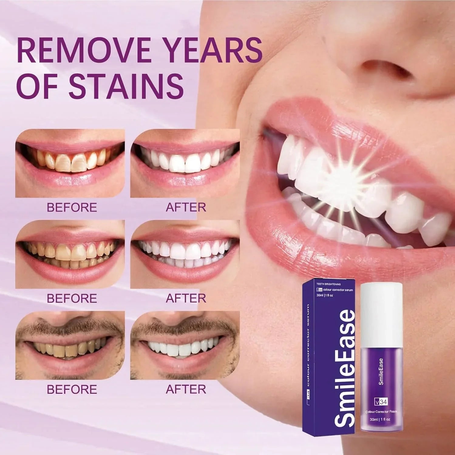 Smile Ease | ابتسامة سهولة