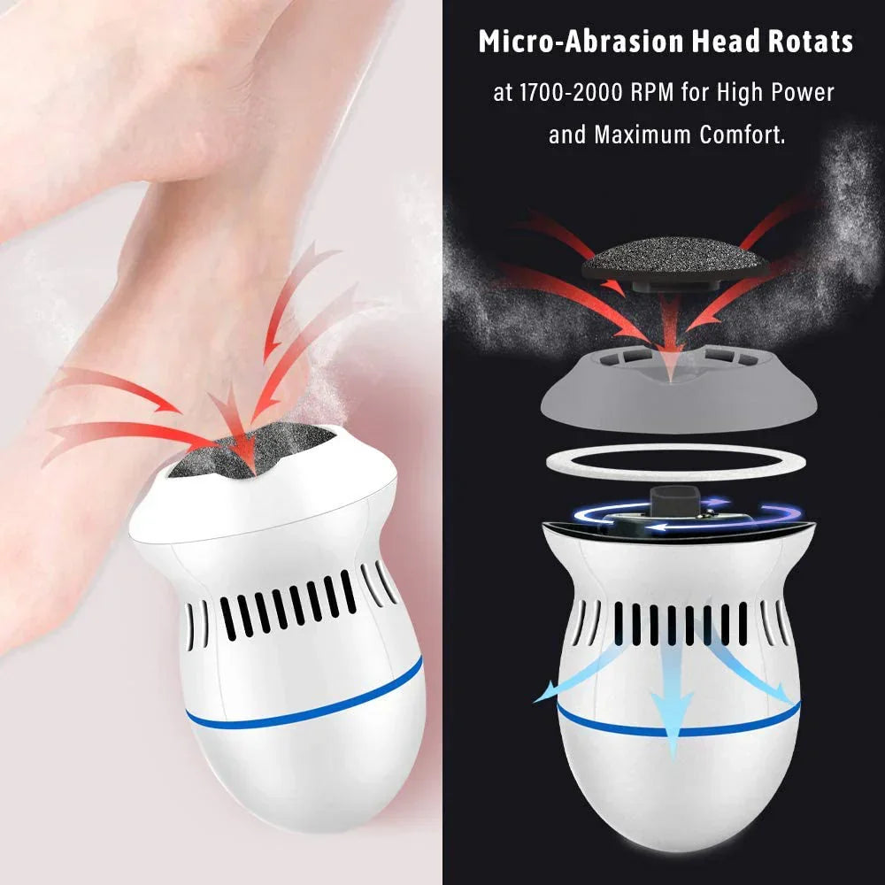 Electric Callus Remover | مزيل الجلد الميت الكهربائي